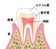 歯周病とは